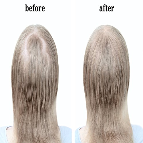 image for Leka HairCare Leka Hair Fibers - Best Keratin Hair Fibers Instantly Th