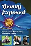 Fasten Your Seatbelt A Crash Course On Down Syndrome For Brothers And Sisters Brian Skotko