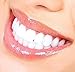 Teeth Whitening Premium Kit - Professional Results From Home! 3-D Teeth Whitening Kit - Great Price, Immediate Results, And Whiter Teeth!