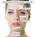Vitamin C 21% Serum- Preventing Skin Troubles of Ageing, Fine Lines, Deep Wrinkles, Age Spots, Dull Skin, Flabby and Sagged Skin, Acne, Pimples & Blemish.