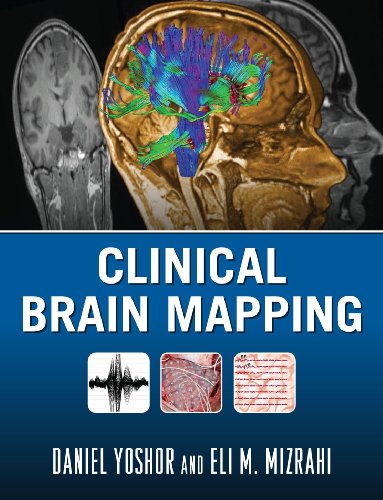 CLINICAL BRAIN MAPPING