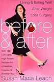 Before and After: Living and Eating Well After Weight Loss Surgery