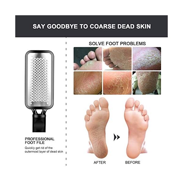 FOLAI-Foot-File-Foot-Pedicure-Tool-Stainless-Steel-Foot-File-Dead-Skin-Remover-Foot-Care-Pedicure-Tool-for-Cracked-Feet-Make-Foot-Beauty-and-Extra-SmoothBlack FOLAI Foot File Foot Pedicure Tool, Stainless Steel Foot File, Dead Skin Remover Foot Care Pedicure Tool for Cracked…