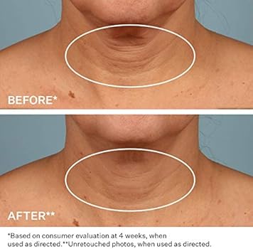 optimals hydra matte night cream