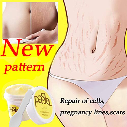 striae treatment cream