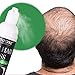 BUOCEANS Hair Growth Products, Hair Regrowth, Hair Growth Treatment, Hair Loss & Hair Thinning Treatment, Extra Strength Hair Growth Treatment Foam, One Month Supplythumb 1
