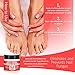 Natrulo Nail & Toenail Fungus Treatment - Herbal Anti Fungal Cream with Tolnaftate & Essential Oils - Destroys Fungus & Restores Clear Healthy Nails - Effective Proven Formula Made in the USA