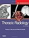 Thoracic Radiology: The Requisites (Requisites in Radiology)