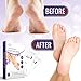 Villini Foot Peel Mask - Deep Exfoliating Peel Off Mask for Women and Men - Foot Peeling Mask - Calluses and Rough Dead Skin Remover - Wow-Effect after One Use (15-pairs)