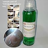 Green Peeling Oil - Mild Peel 120ML by Derma Obsession