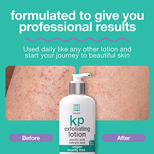 TOUCH Body Lotion for Keratosis Pilaris with 12 Glycolic Acid Lotion