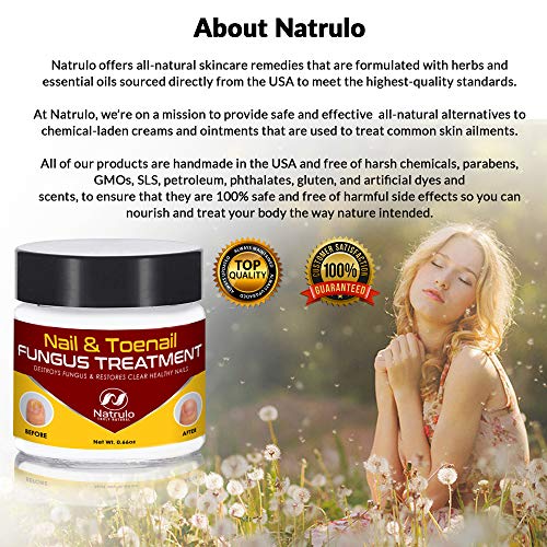 image for Natrulo Nail & Toenail Fungus Treatment - Herbal Anti Fungal Cream wit