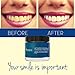 Purest Naturals Teeth Whitening Charcoal Powder Natural - Made In USA With Coconut Activated Charcoal - Safe Effective Tooth Whitener Solution - Better Than Strips, Kit, Gel & Whitening Toothpaste