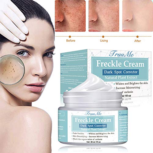 Freckle Cream, Dark Spot Corrector, Melasma Cream, Natural Gentle Skin