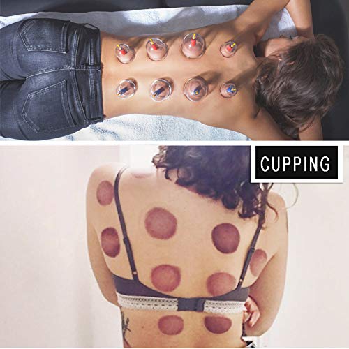 6 Cupping+Professional+Acupoint+Magnetic+Cellulite