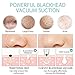 Blackhead Remover Pore Vacuum, CLSEVXY Rechargeable Facial Pore Cleanser Acne Comedone Extractor Zit Sucker Tool - Advanced Blackhead Suction Device for Cleansing Pore and Removing Blackhead