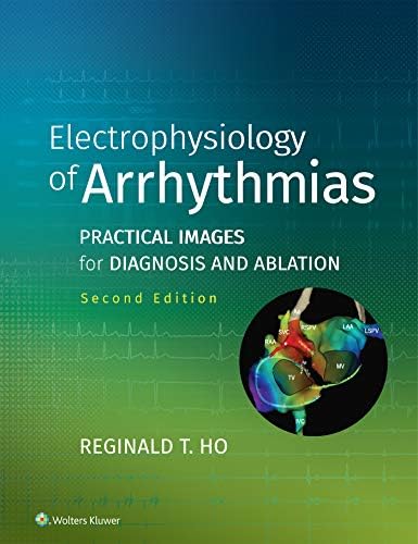 Amazon.com: The EHRA Book of Interventional Electrophysiology