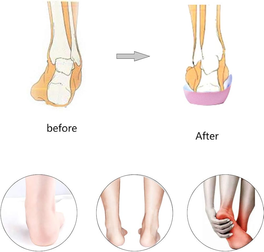 flats for high arches