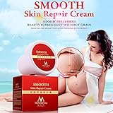 Siam Glorious Stretch Marks Scar Removal Skin Repair Body Cream Remove Scar Care Postpartum 35g