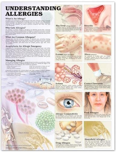 Understanding Allergic reactions Anatomical Chart