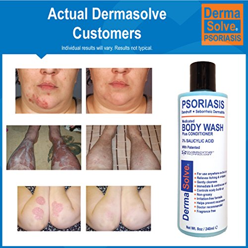 Psoriasis Body Wash by DermaSolve (2Pack) Psoriasis, Eczema