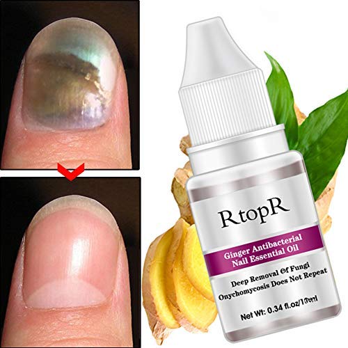 Yiwa Anti Fungal Nail Infection Toe Nail Fungus Treatment Essential Oil Repair Ginger Antibacterial Nail Treatment Onychomycosis Paronychia Liquid
