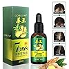 Ginger Germinal Oil, Hair Growth Oil, Hair Growth Serum, Ginger Germinal Essential Oil, Hair Loss Treatment Hair Care…