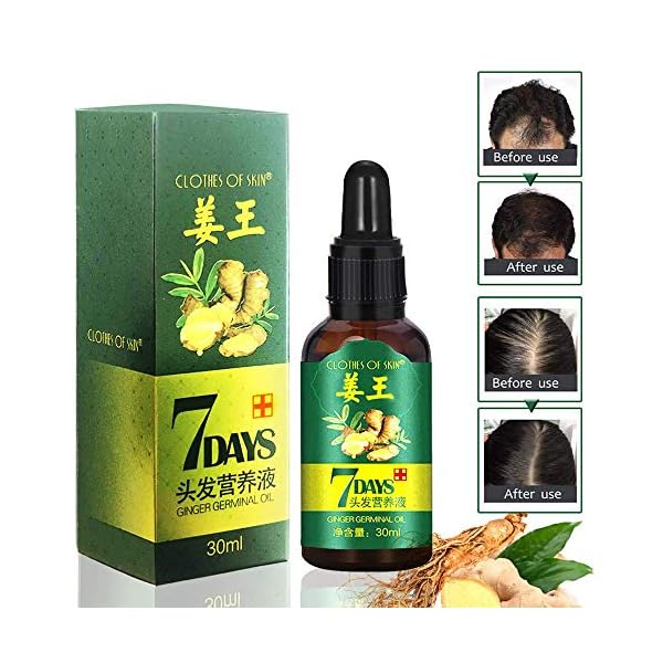 Ginger Germinal Oil, Hair Growth Oil, Hair Growth Serum, Ginger Germinal Essential Oil, Hair Loss Treatment Hair Care…
