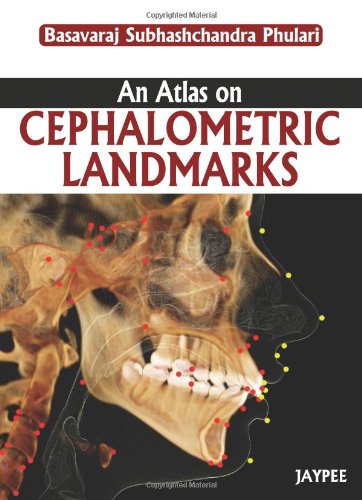 Download An Atlas on Cephalometric Landmarks