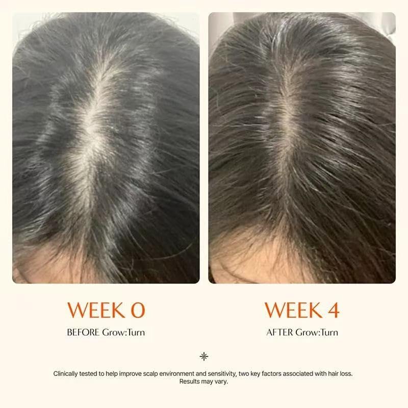 YOOJ® GROWTURN Hair Growth Serum with Built-in Applicator Brush, Heartleaf-Derived Exosomes, Scalp Massager, Scalp Revitalizing Korean Hair Care