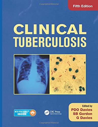Clinical Tuberculosis Clinical Tuberculosis