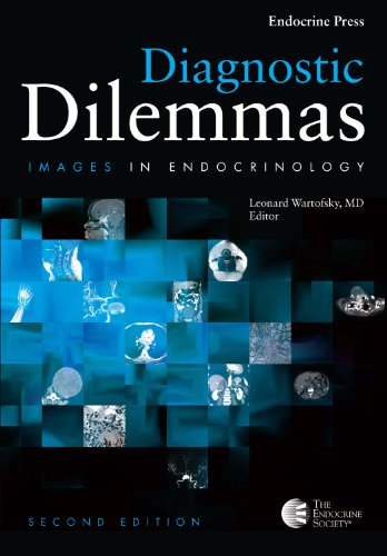 Diagnostic Dilemmas: Images In Endocrinology Volume 2 Reviews