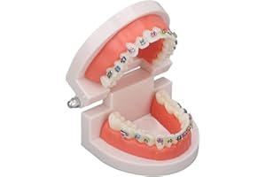 Typodont Teeth Model with Metal Bracket, model fake braces for teeth pathological Study for Dentist