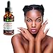 Sky Organics Vitamin C Serum for Face with Hyaluronic Acid, Vitamin C 20%+B+E- Pro Strength Antioxidant Facial Skin Care Helps Repair Sun Damage, Age Spots, Dark Circles, Wrinkles & Fine Lines 1oz 