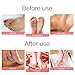 Earth Lava Pumice Stone for Foot, Horsky SPA Soft Healthy Foot Callus Remover for Dry Hard Dead Skin Cracked Heel in Feet and Hands Skin Exfoliator Scrubber Drops Shape