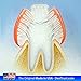 6 Pack : DENTRUST 3- Sided Special Needs Toothbrush : Fun and Easy: Complete Oral Care