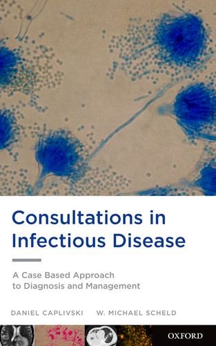 Consultations in Infectious Disease A Case Based Approach to Diagnosis and Management (Paperback)