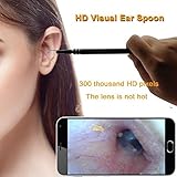 Visual Endoscope,Ear Endoscope Only for Android PC Video Scope Waterproof USB Andriod Ear Otoscope Clean Inspection Camera Ear Pick Otoscope OTG UVC-4.5FT