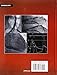 Grossman's Cardiac Catheterization, Angiography, And Intervention