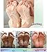 Japanese Hyaluronic Acid Baby Feet Highly Effective Peeling Foot Mask Stop Unpleasant Odor Remove Calluses and Dead Skin Treat Cracked Heels - 2 socks