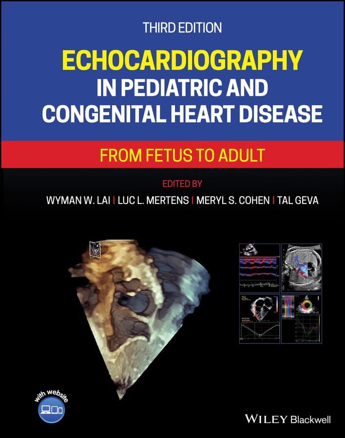Amazon.com: Echocardiography in Pediatric and Adult Congenital