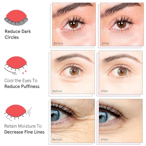 BRIGHTENING EYE MASK – HYALURONIC ACID EYE MASK WITH CAFFEINE,UNDER EYE PATCHES FOR PUFFY EYES AND DARK CIRCLES – 60 EYE PATCHES TO MINIMIZE WRINKLES AND ELIMINATE ，UNDER EYE CARE (1PCS)