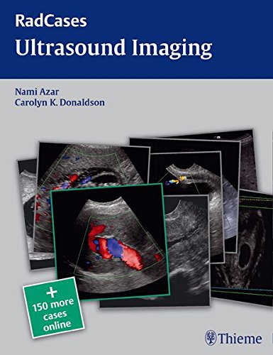 Read Radcases Ultrasound Imaging (Radcases Plus Q&A) [P.D.F]