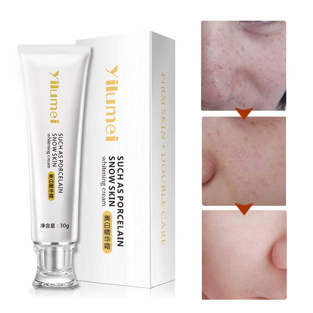 blemish whitening cream