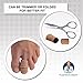 Dr. Frederick's Original Fabric Toe Caps - Toe Separators - 3 Pairs - Size Large