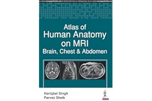 Atlas of Human Anatomy on MRI: Brain, Chest and Abdomen