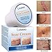 Scar Cream, Scar Treatment, Stretch Mark Cream, Scar Removal Cream, Acne Spots Treatment, Scar Cream for Face & Body, Old & New Scars from Cuts, C-Sections & Surgeries (35g)