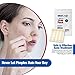 Acne Patches for Face - Hydrocolloid Bandages (24 Count) Pimple Patches for Face in 3 Universal Sizes, Acne Spot Treatment Care for Face & Skin Spot Patch Conceals Zits, Acne and Blackheads