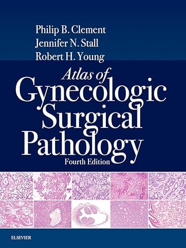 Amazon.com: Diagnostic Histopathology of Tumors E-Book: Expert