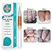 Y.F.M Toenail Treatment, Toenail Care, Nail Treatment Pen Nail Gel, Effective Nail Treatment, Toenails & Fingernails Solution, 3 ml